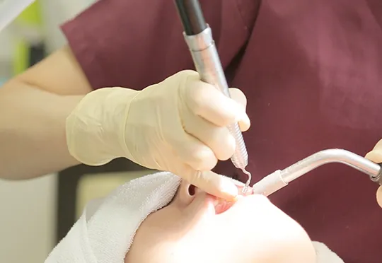 歯科医院でのクリーニングの必要性