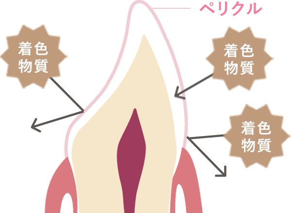 ホワイトニング前の歯