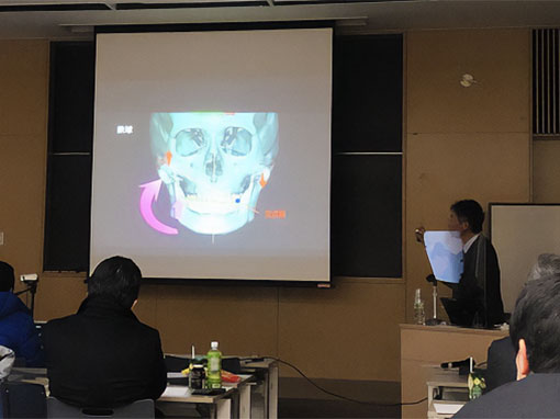 インプラント臨床研修会関西支部研修会で「3次元6自由度診断による適正下顎位誘導」についてプレゼンしました