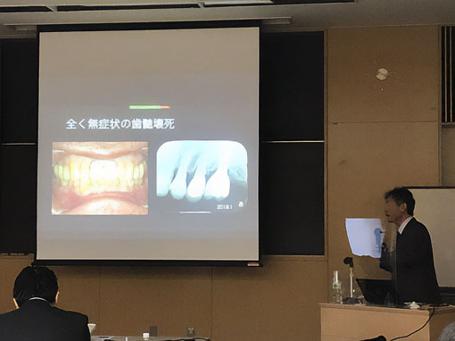 インプラント臨床研修会関西支部研修会で「3次元6自由度診断による適正下顎位誘導」についてプレゼンしました